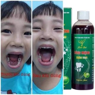 Răng miệng Xuân Vinh 200ml
