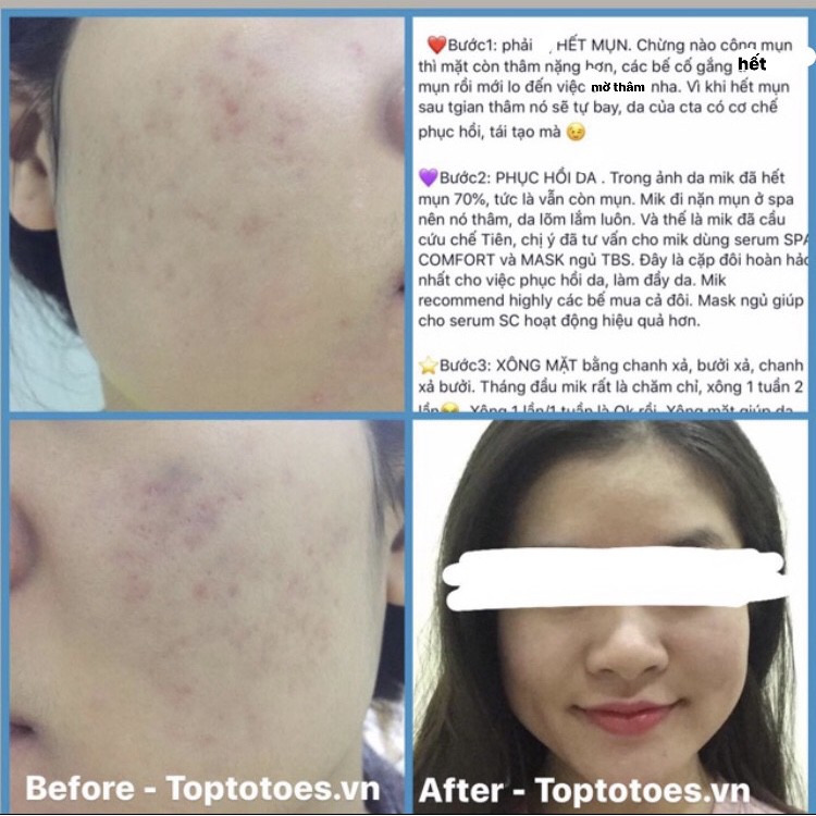 Serum Teana Stress Control Spa Comfort 20ml phục hồi &amp; tái tạo da yếu, giảm nhăn rỗ, cấp nước dưỡng ẩm, se lỗ chân lông