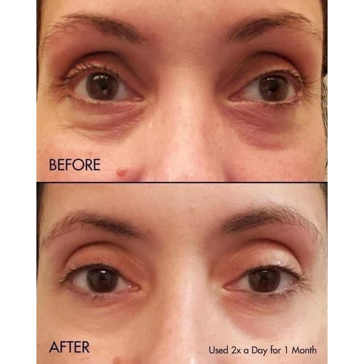 Kem dưỡng mắt SNP W+ Bird's Nest Eye Cream Chính Hãng