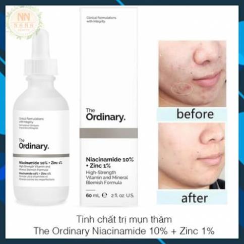 Tinh chất Serum The Ordinary Niacinamide 10% + Zinc 1% siêu dưỡng da ⭐