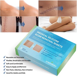 Miếng dán mờ Sẹo Silicone Y Tế Puriderma giúp làm mờ Sẹo lồi, Phẫu thuật, Bỏng, Mụn trứng cá, Sẹo Căm - 1 miếng