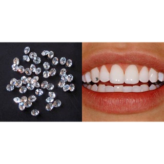 Đá đính răng/ kim cương nhân tạo