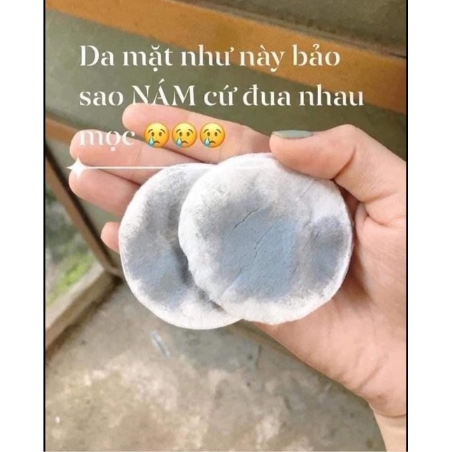 Kem Thải Chì Nhân Sâm Hàn Quốc, Anti- Melasma Cream 30gr - MQ Skin chính hãng