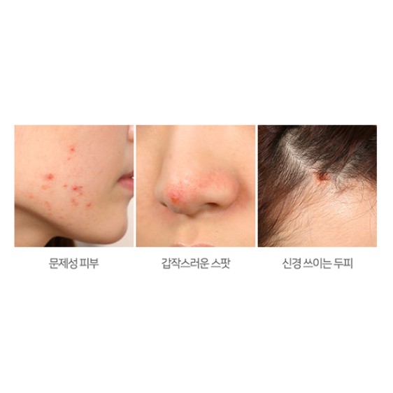 Tinh Dầu Tràm Trà "Thần Kỳ" Some By Mi 30 Days Miracle Tea Tree Clear Spot Oil 10ml