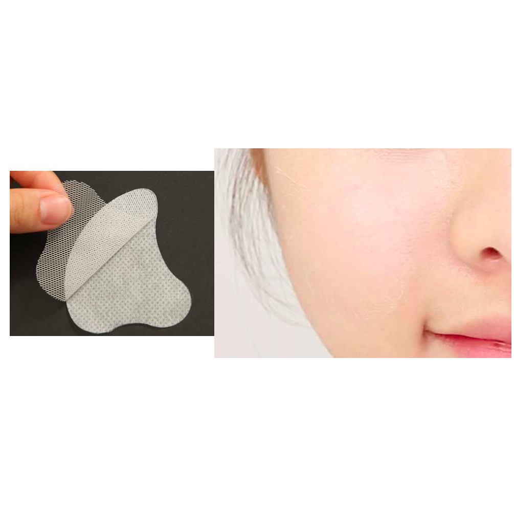 MBC Mặt nạ ngủ dưỡng ẩm sâu Skin Moisturizing Film Sleeping Pack SN Derma Skin Fit Patch 1 túi 2 miếng | BigBuy360 - bigbuy360.vn