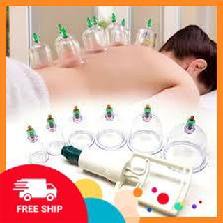 [FREE SHIP] Bộ giác hơi không dùng lửa 10 ly