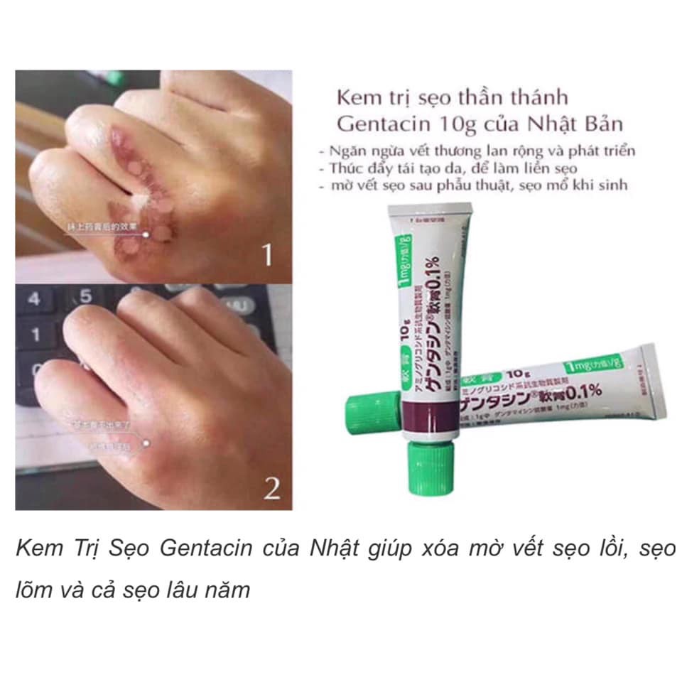 Kem cải thiện SẸO Gentacin Nhật Bản tuýp 10g Hỗ Trợ Cải Thiện Sẹo Lồi Sẹo Lõm Sẹo Cứng Đầu