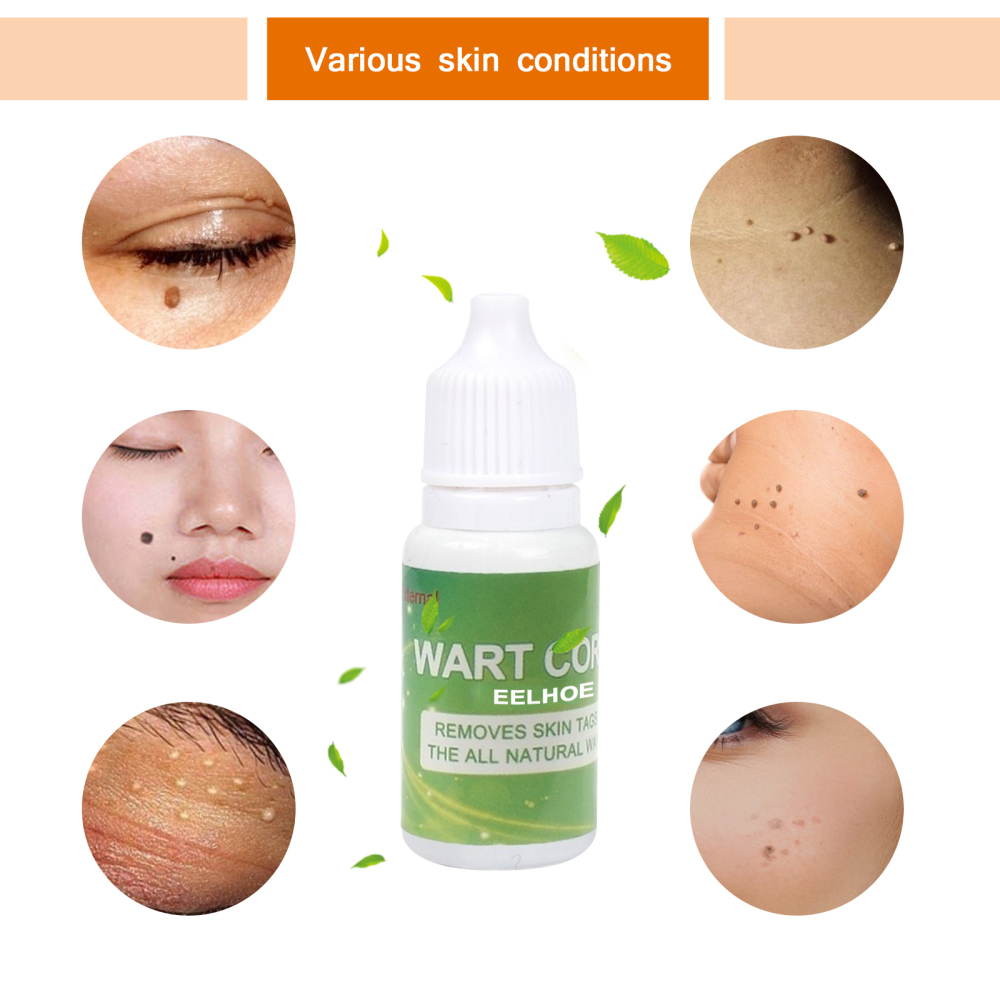 ☀☀☀ Skin Tag Cure Removal Body Mole Wart Remover Spot Marks Wart Remover ☝☝☝