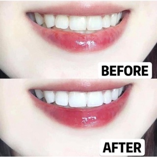 Combo kem đánh răng và bột làm trắng răng Eucryl