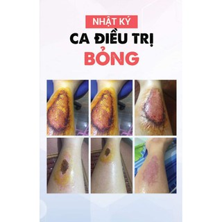 (IB lấy mã) Maxibac Spray và Maxibac gel