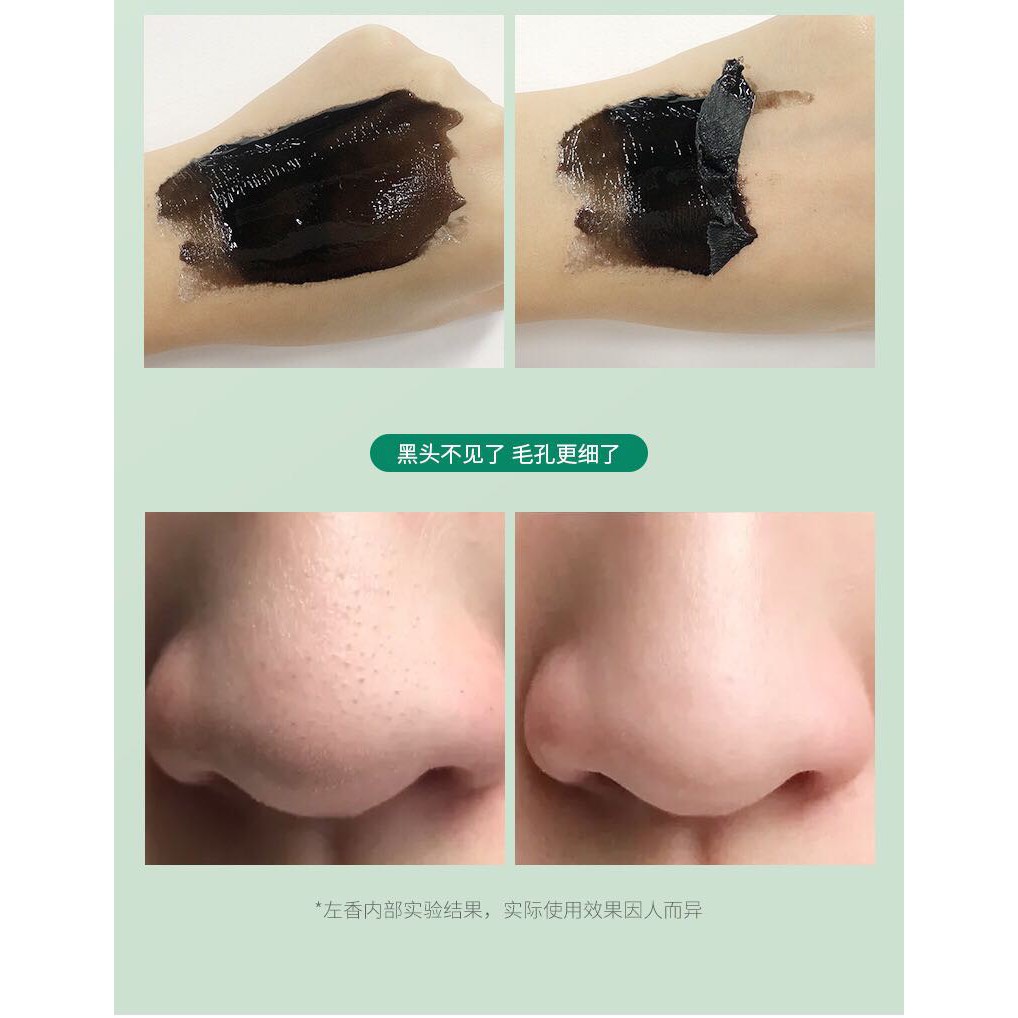 [HOT] ✨GEL LỘT MỤN ĐẦU ĐEN / ĐẦU TRẮNG / MỤN CÁM BLACK HEAD REMOVER✨