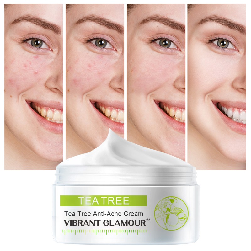 Kem dưỡng da VIBRANT GLAMOUR 30g chiết xuất dầu tràm giúp giảm mụn kiểm soát dầu làm dịu da và giữ ẩm không nhờn rít