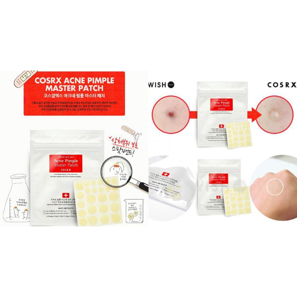 Miếng dán mụn Acne Pimple Master Patch Cosrx ( màu đỏ )