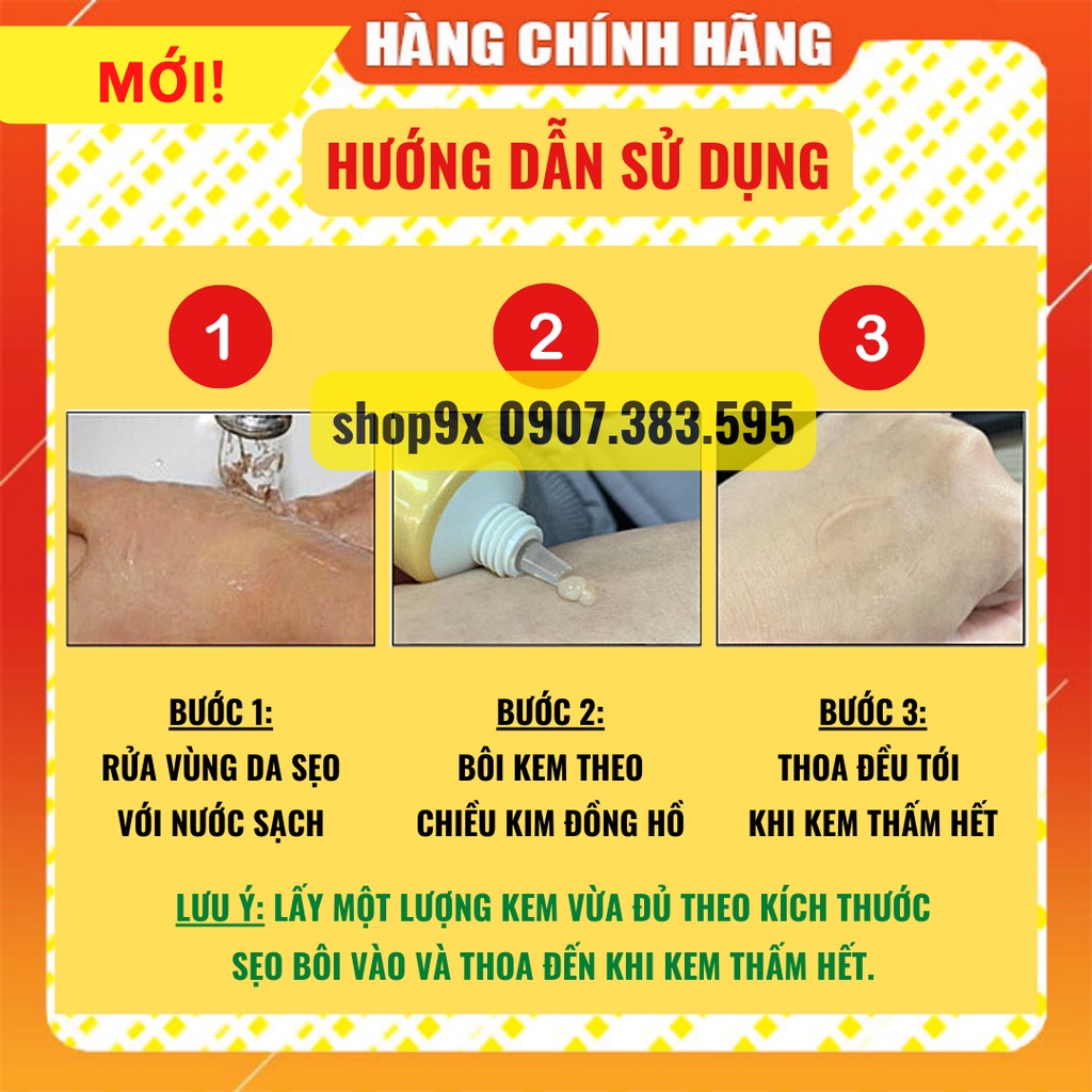 Kem Sẹo Peimei - Giảm Sẹo Và Rạn Da Hiệu Quả Sau 1 Tuần 30gr