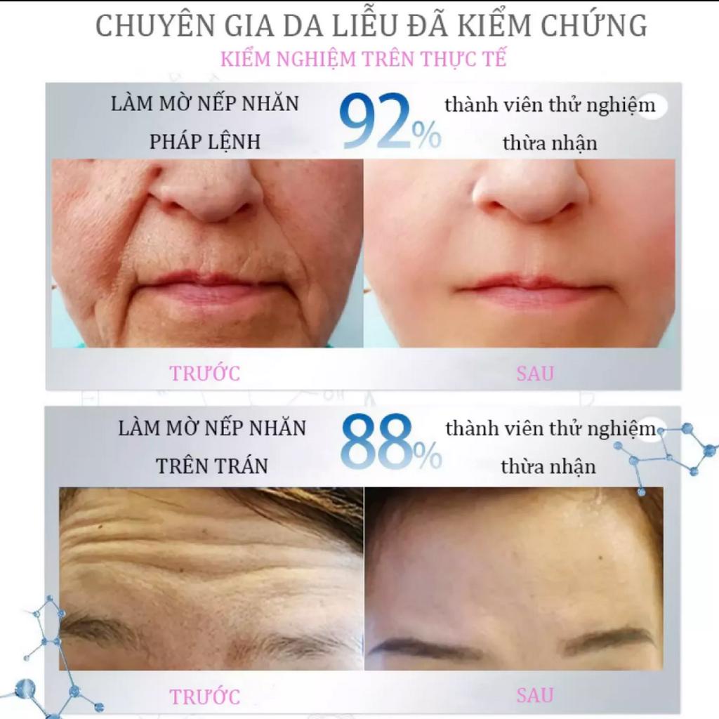 Serum dưỡng trắng Serum chống lão hóa Serum căng bóng da mặt 30ml slàm mờ nếp nhăn,ngăn ngừa lão hóa da, phục hồi độ đàn hồi của da, Giữ ẩm cho làn da mịn màng và trắng sáng