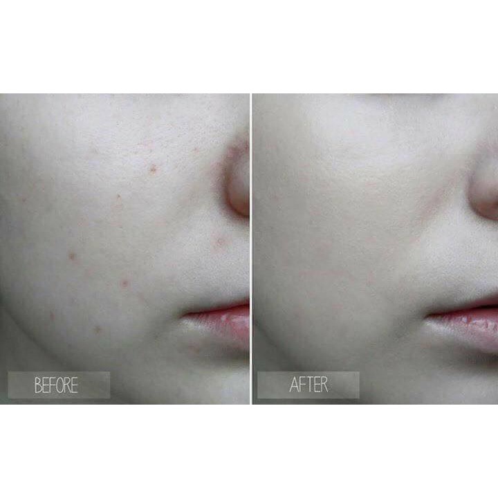 Kem nền BB Cream Back to Baby #3CE | BigBuy360 - bigbuy360.vn