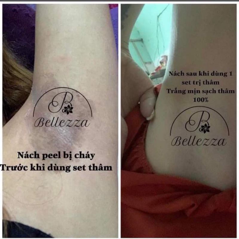 KEM KHỬ THÂM VÙNG NÁCH BẸN BELLEZZA | BigBuy360 - bigbuy360.vn