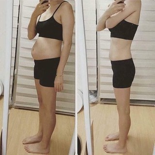 Miếng dán giảm mỡ bụng hộp 5 chiếc