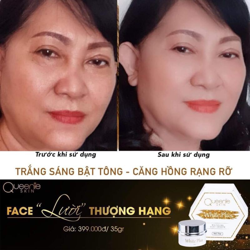 Face Lười thượng hạn Queenie Skin 35g | BigBuy360 - bigbuy360.vn