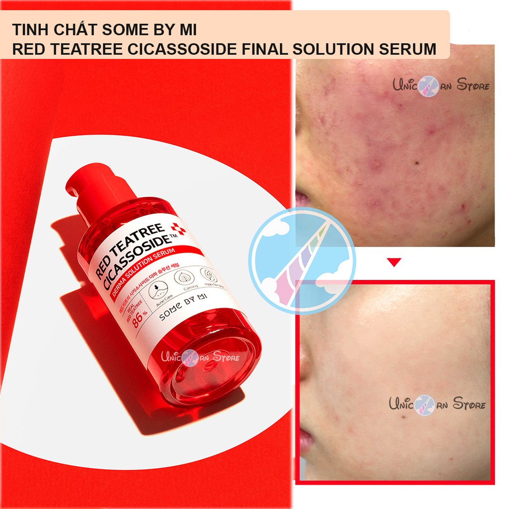 Tinh Chất Ngừa Mụn Chiết Xuất Tràm Trà Đỏ Some By Mi Red Teatree Cicassoside Serum 50mL