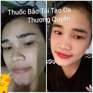 Combo Thuốc tái tạo(50ml)+bột rửa+hồng da
