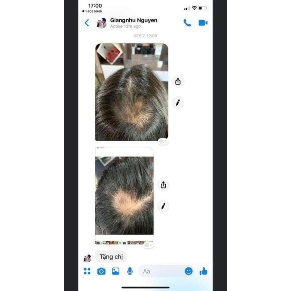 SupHerb Multi Hair Vitamin kích thích mọc tóc Do Thái