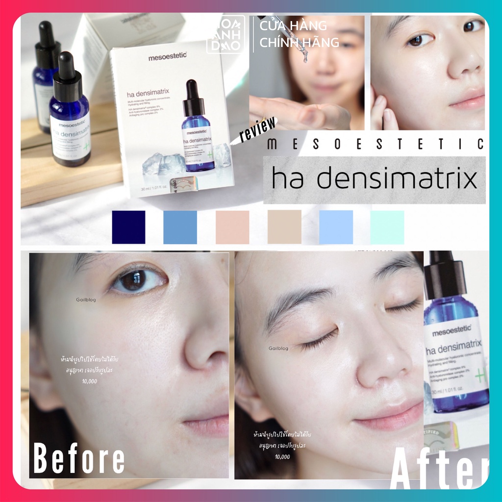 Serum dưỡng ẩm và chống lão hóa Mesoestetic HA Densimatrix 30ml