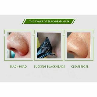 Mặt nạ lột mụn Black Head