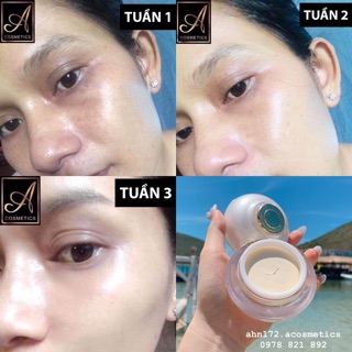 Face Pháp (Kem mặt trắng da Acosmetics)