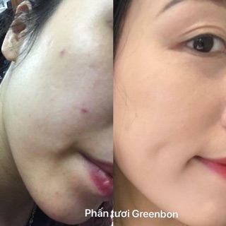 Phấn nước Lotus Cushion Greenbon