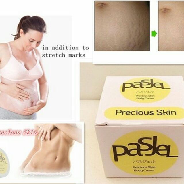 Kem Rạn Da Sau Sinh Pasjel Thái Lan, Mờ Rạn, Mờ Sẹo Hiệu Quả Nhất Rạn Da Sau Sinh Và Rạn Tuỏi Dậy Thì Để Lại Sau 1 Lt