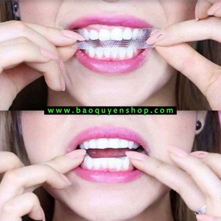 Miếng dán trắng răng Crest 3D Whitestrips Professional Effects - Gói lẻ