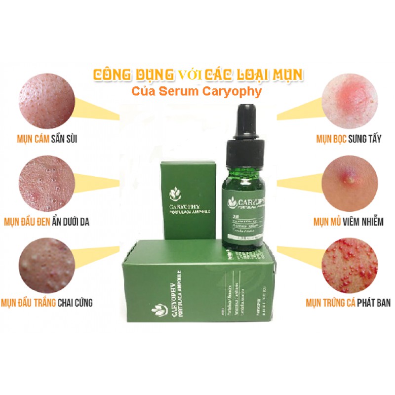 Combo Sữa rửa mặt và Serum giảm mụn thâm từ rau má Caryophy Portulaca