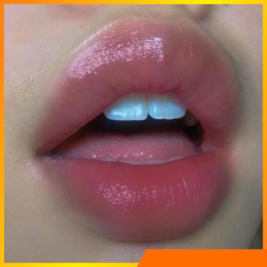 SON Ủ MÔI SHI - MỀN MÔI -DƯỠNG MÔI - HỒNG MÔI - TRỊ THÂM MÔI V V V . | BigBuy360 - bigbuy360.vn