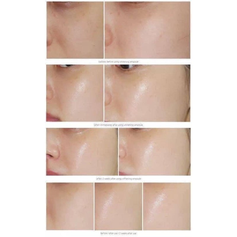 Toner nước hoa hồng cấp ẩm dưỡng trắng căng bóng da Badskin hyaluronic spa và collagen bomb thuỷ phân bad skin