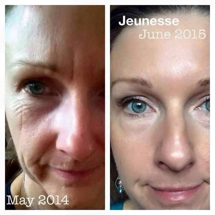 5 ống xóa nhăn tức thì Ageless của Jeunesse | BigBuy360 - bigbuy360.vn