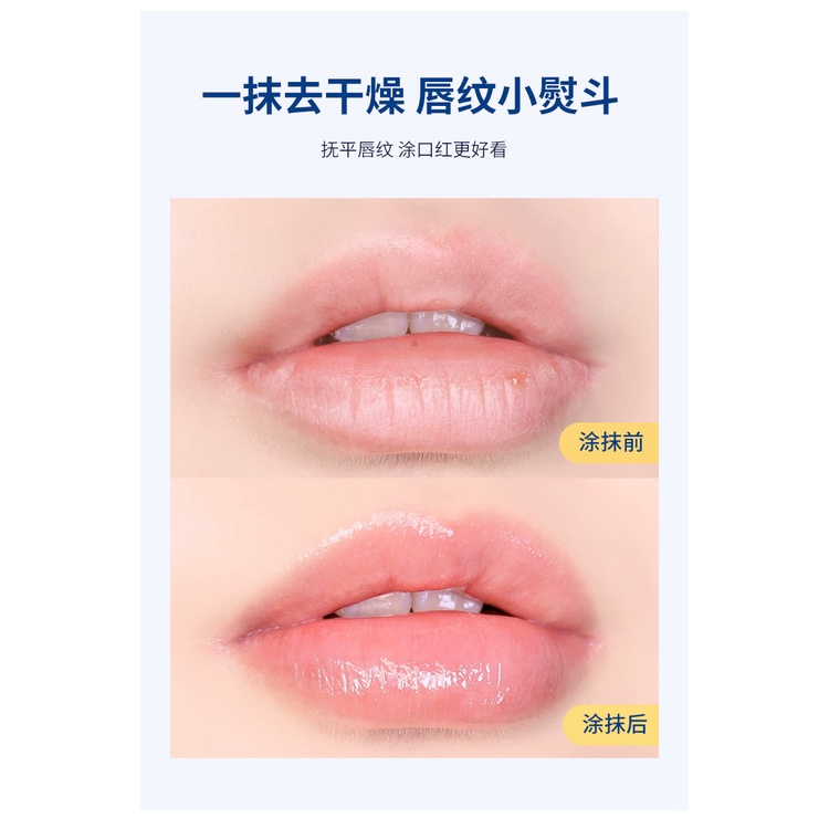 Hộp 4 Hũ VASELINE 7g Dưỡng Môi Đủ Vị Trái Cây