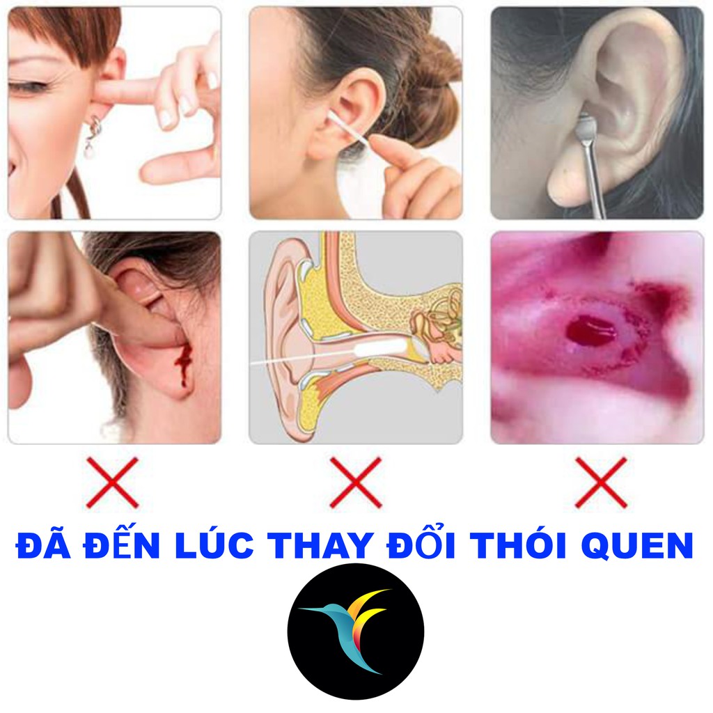 Bộ lấy ráy tai thông minh Bebird R1- Dụng cụ lấy ráy tai thông minh Bebird