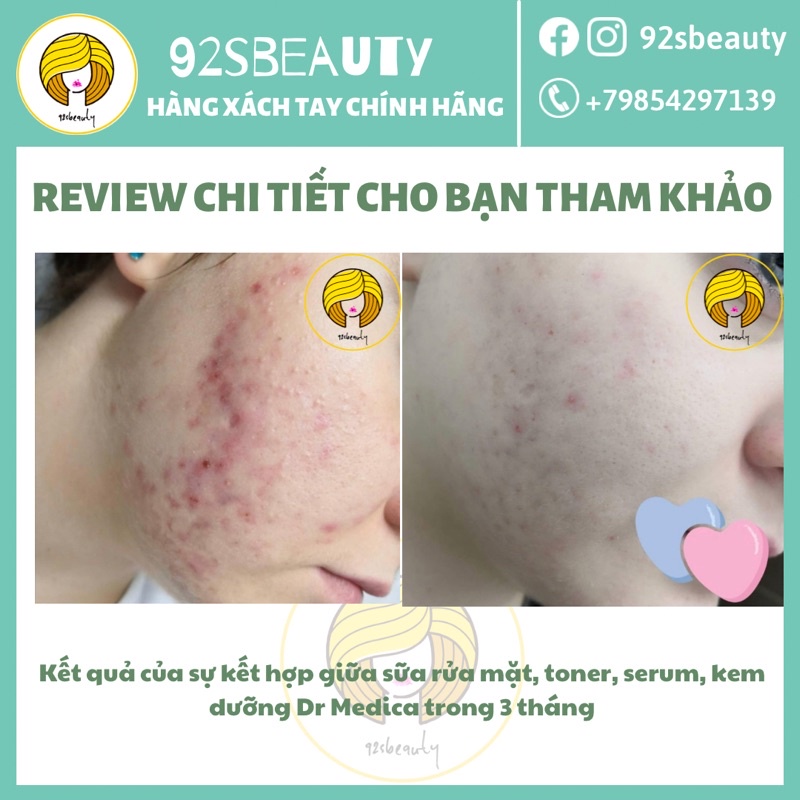 Serum mờ thâm, sáng da, kháng mụn Bielenda Dr Medica Acne Dermatological Anti-Acne