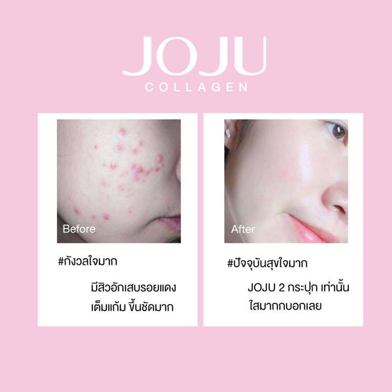 Viên uống duỡng da sáng khoẻ JOJU Collagen