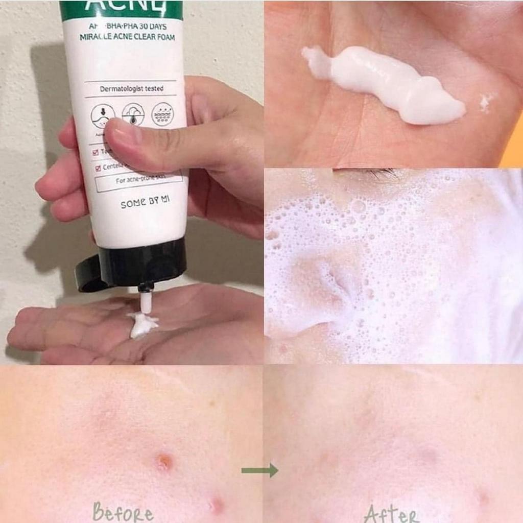 Sữa rửa mặt chuyên biệt cho da dầu mụn, nhạy cảm #SOMEBYMI AHA-BHA-PHA 30
