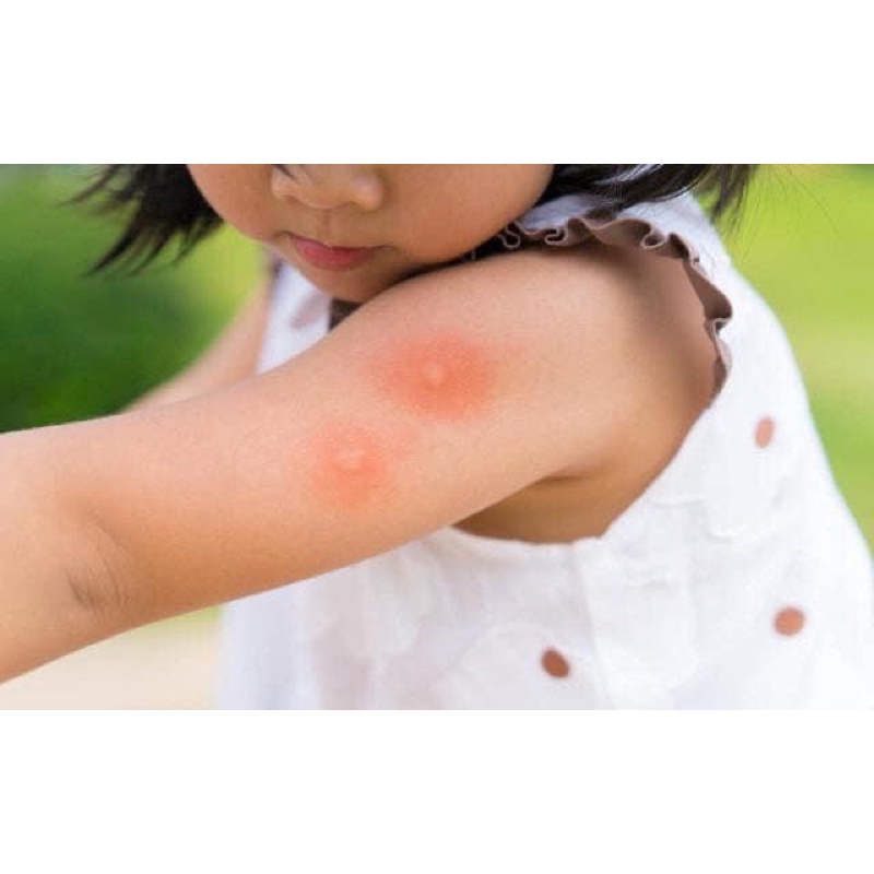 Lăn bôi giảm ngứa do muỗi Muhi Nhật