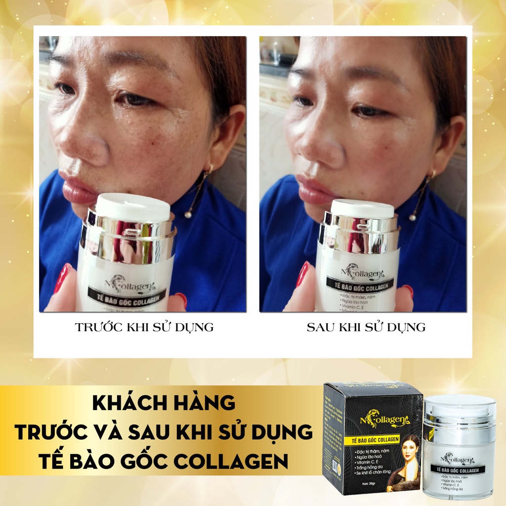 Kem Tế Bào Gốc Cao Cấp N'Collagen - Hỗ trợ giảm ngay mụn, nám, đào thải sắc tố sạm đen 30g