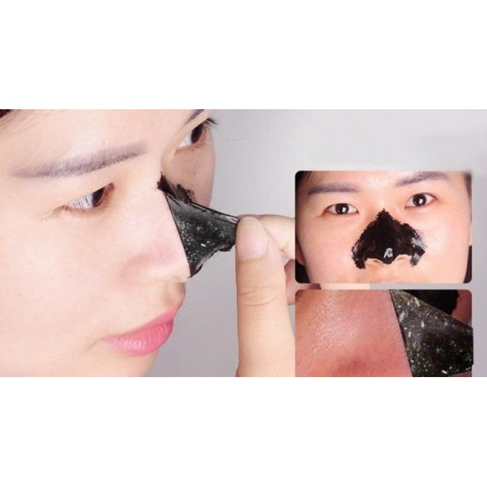 Mặt Nạ Lột Mụn Đầu Đen  Làm Sạch Sâu Thu Nhỏ chân Lông Dưỡng ẩm se lỗ chân lông làm sáng da Skin Caremặt