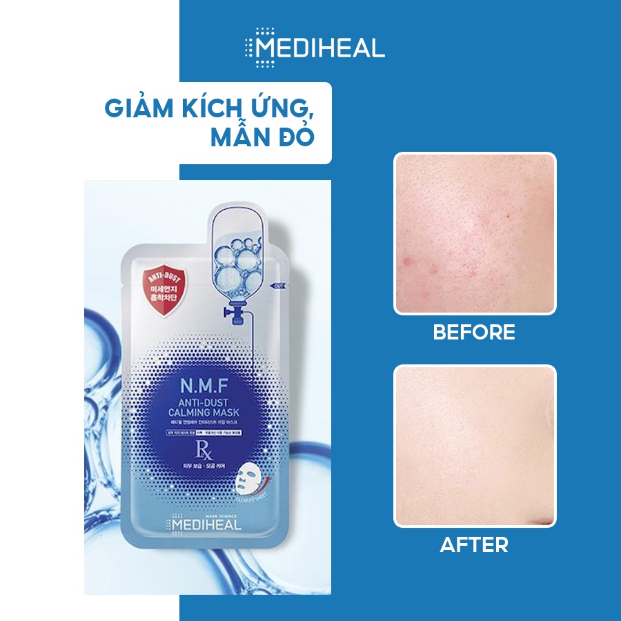 [Mã FMCGMALL - 8% đơn 250K] Mặt Nạ Thải Độc, Cấp Nước Và Phục Hồi Da Mediheal N.M.F Anti-Dust Calming Mask 27ml [K56]