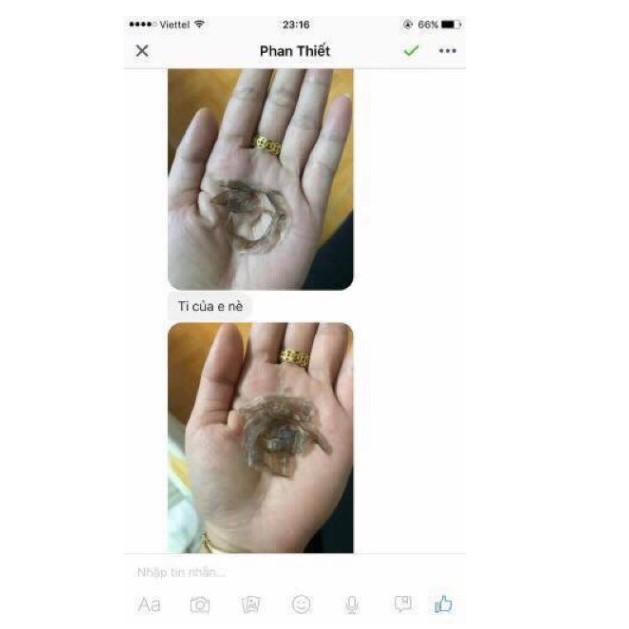 Hàng Hot Peel Nhũ Hoa Hỗ Trợ Làm giảm Thâm Vùng Kín- Nách Bẹn - Bikini - Mông hàng độc quyền | BigBuy360 - bigbuy360.vn