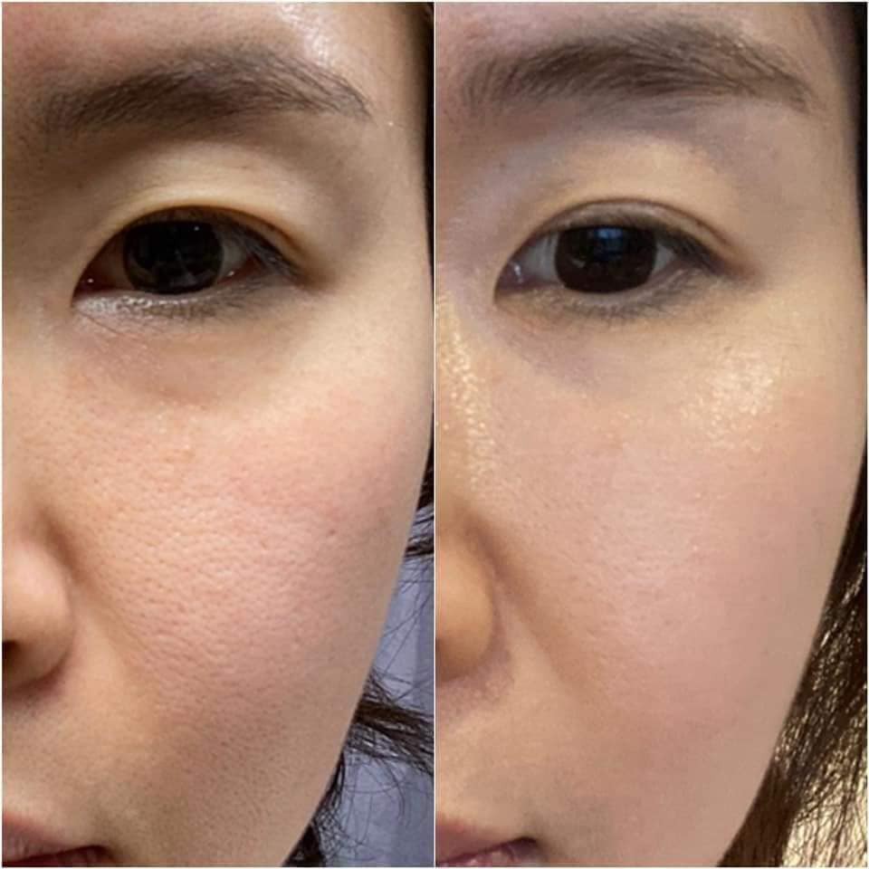 Bộ sản phẩm chức năng kép giúp trẻ hoá tái sinh, giảm nếp nhăn, làm trắng da Cell Fuller