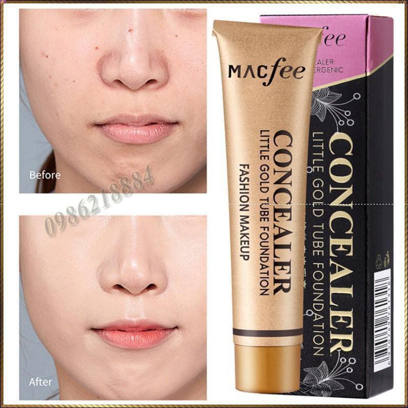 Kem nền che khuyết điểm toàn diện Macfee Concealer Hypoallergenic PH