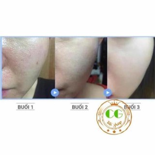 Bột đậu đỏ 100g