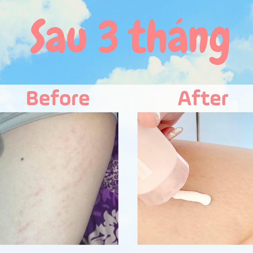 Kem Chống Rạn Da RE:P Giảm Rạn Da Bụng Đùi Săn Chắc Da Làm Mờ Sẹo RE:P NATURAL HERB ULTRA FIRMING STRETCH CREAM 200ml